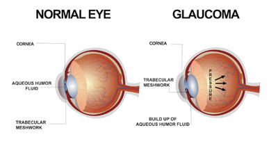�쳻�� ����